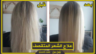 علاج الشعر المتقصف