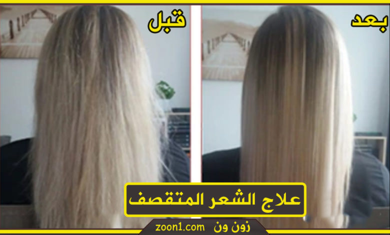 علاج الشعر المتقصف